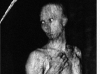 BaummannTreeman